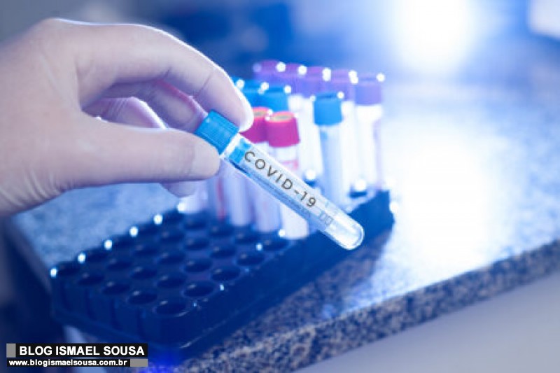 Sesap nÃ£o registra Ã³bitos por Covid-19 nas Ãºltimas 24h