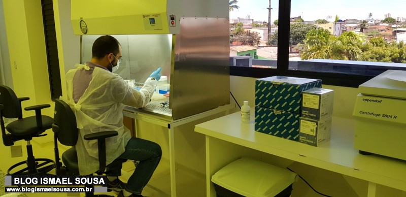 UFRN adquire kits e comeÃ§a a testagem para Novo Coronavirus