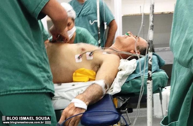 MÃ©dicos controlam hemorragia e quadro de Bolsonaro Ã© estÃ¡vel