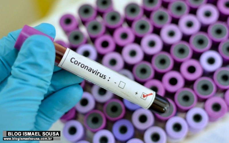 1Âº caso oficial de reinfecÃ§Ã£o por coronavirus no RN Ã© tratado como o fim do mundo