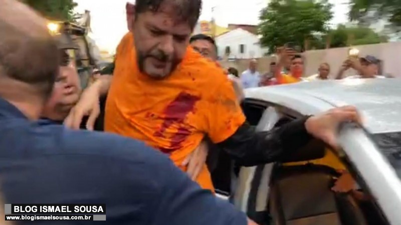 Cid Gomes foi atingido por dois tiros de pistola, afirma CBN Fortaleza
