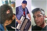 Sanfoneiro acusa Dedim Gouveia de agressÃ£o durante show