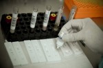 RN comeÃ§a a descer do platÃ´ de casos coronavÃ­rus, afirma Sesap